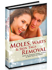 Moles Warts Removal