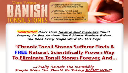 Banish Tonsil Stones Review