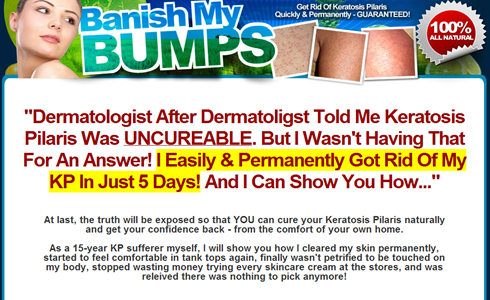 Banish My Bumps Review