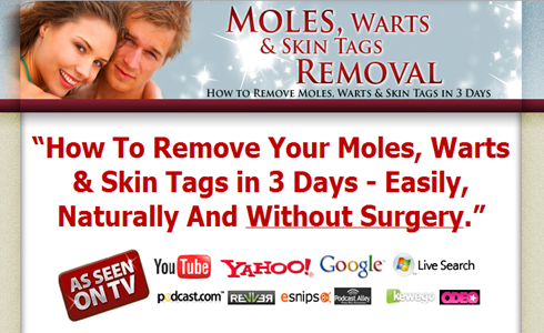 Moles Warts Removal Review